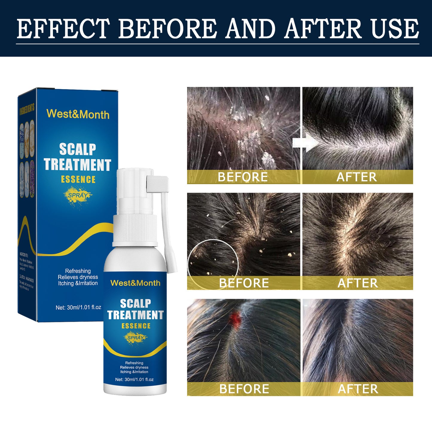 Hair Root Care Spray