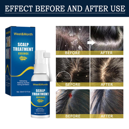 Hair Root Care Spray